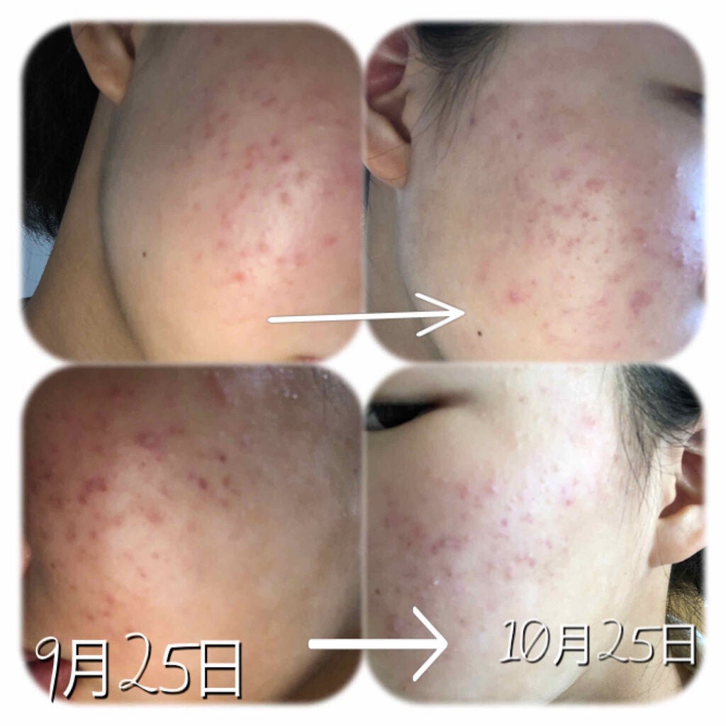 うるおい ジェル/ちふれ/オールインワン化粧品を使ったクチコミ(3枚目)