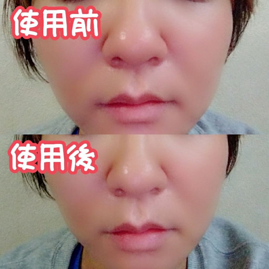 ピントアップラインセラム/Pintup/美容液を使ったクチコミ(4枚目)