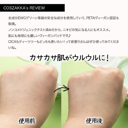 ティーツリー シカ89.4% リファイニングパッド/Vertty/トナーパッドを使ったクチコミ(4枚目)