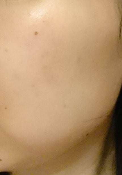 モイストバランス ローション/ACSEINE/化粧水を使ったクチコミ(1枚目)