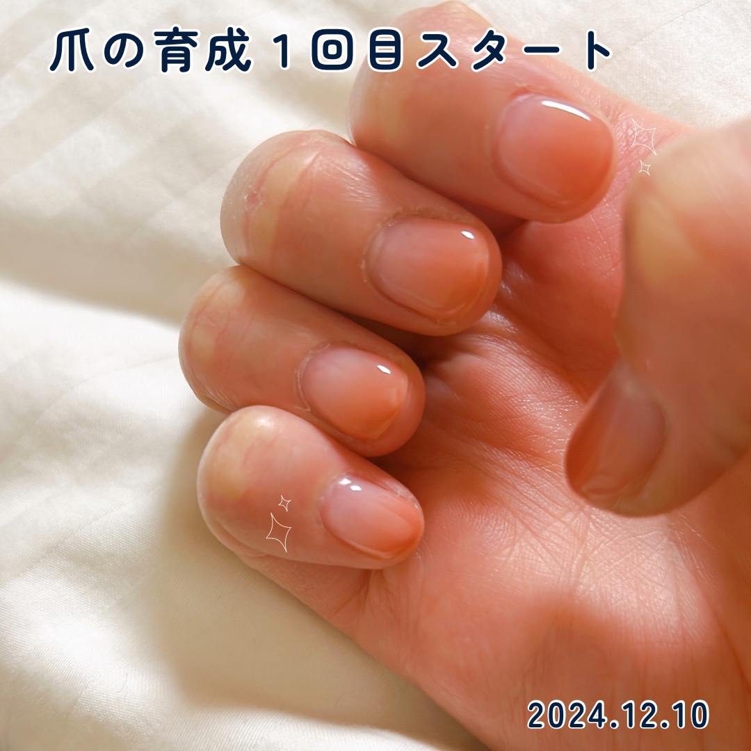 バイオイル/バイオイル/フェイスオイルを使ったクチコミ（1枚目）