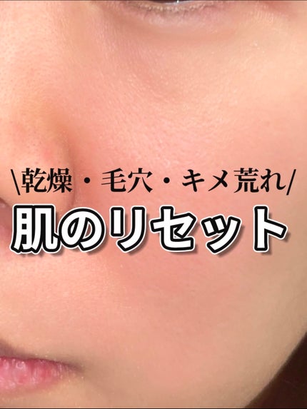 アドバンス ナイト リペア SMR コンプレックス/ESTEE LAUDER/美容液を使ったクチコミ(1枚目)