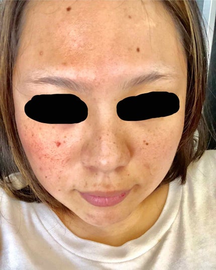 アクティブデイリービタミン/オルビス/美容サプリメントを使ったクチコミ(2枚目)