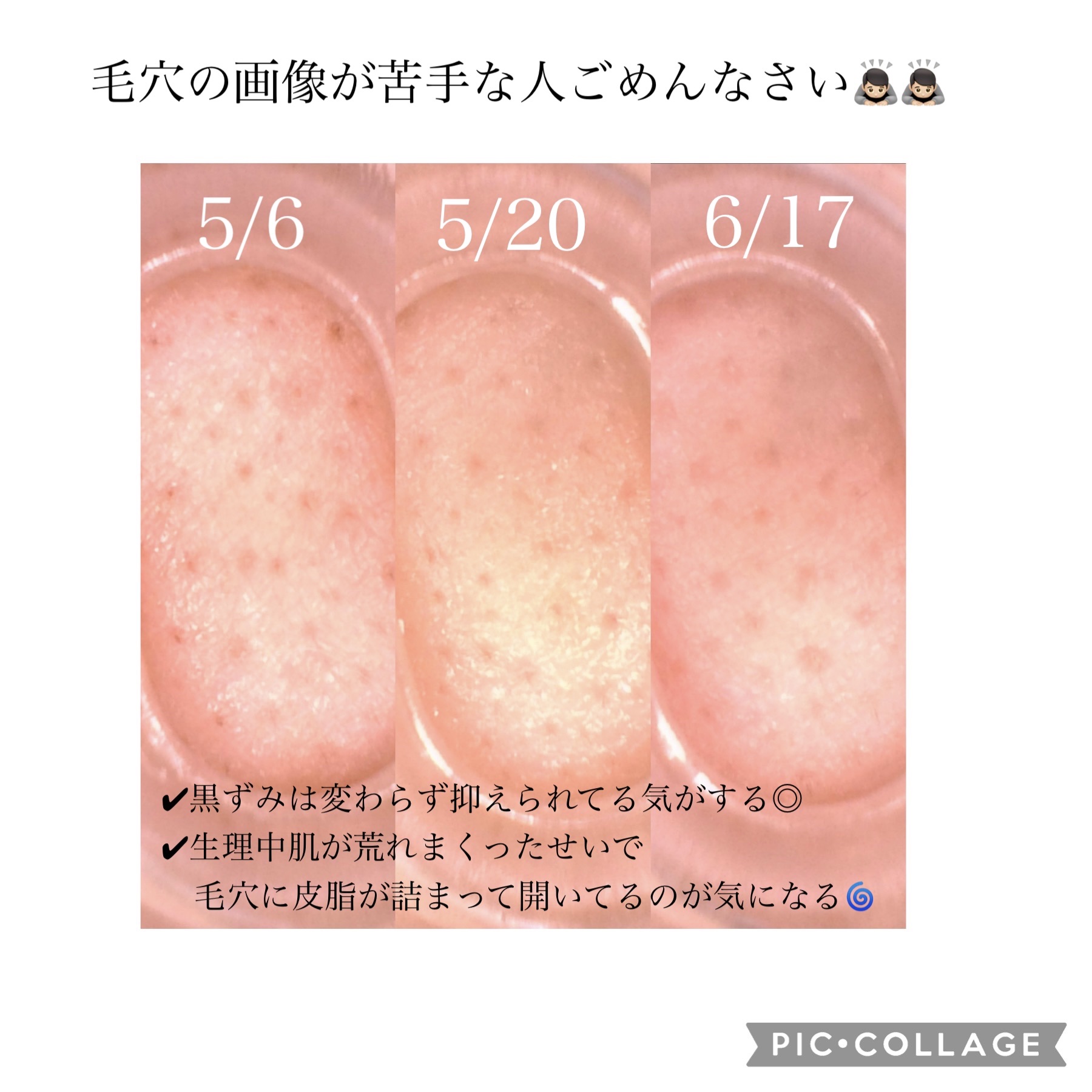薬用しみ対策 美白化粧水 しっとりタイプ/メラノCC/化粧水を使ったクチコミ（3枚目）
