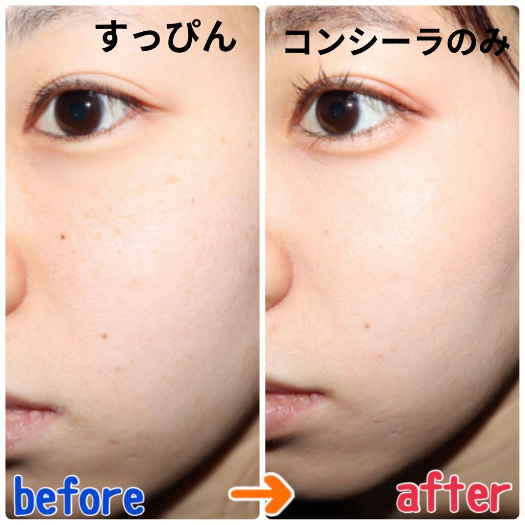 【旧】ディオールスキン フォーエヴァー スキン コレクト コンシーラー/Dior/リキッドコンシーラーを使ったクチコミ(4枚目)