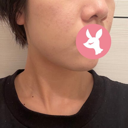 インテンシブ スキン セラム クッション ファンデーション/BOBBI BROWN/クッションファンデーションを使ったクチコミ(3枚目)