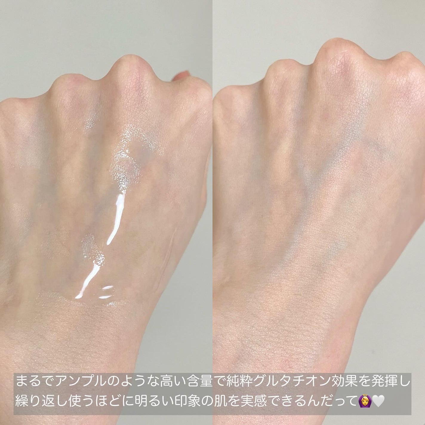 グルタチオンアンプルトナー/SKIN&LAB/化粧水を使ったクチコミ(5枚目)