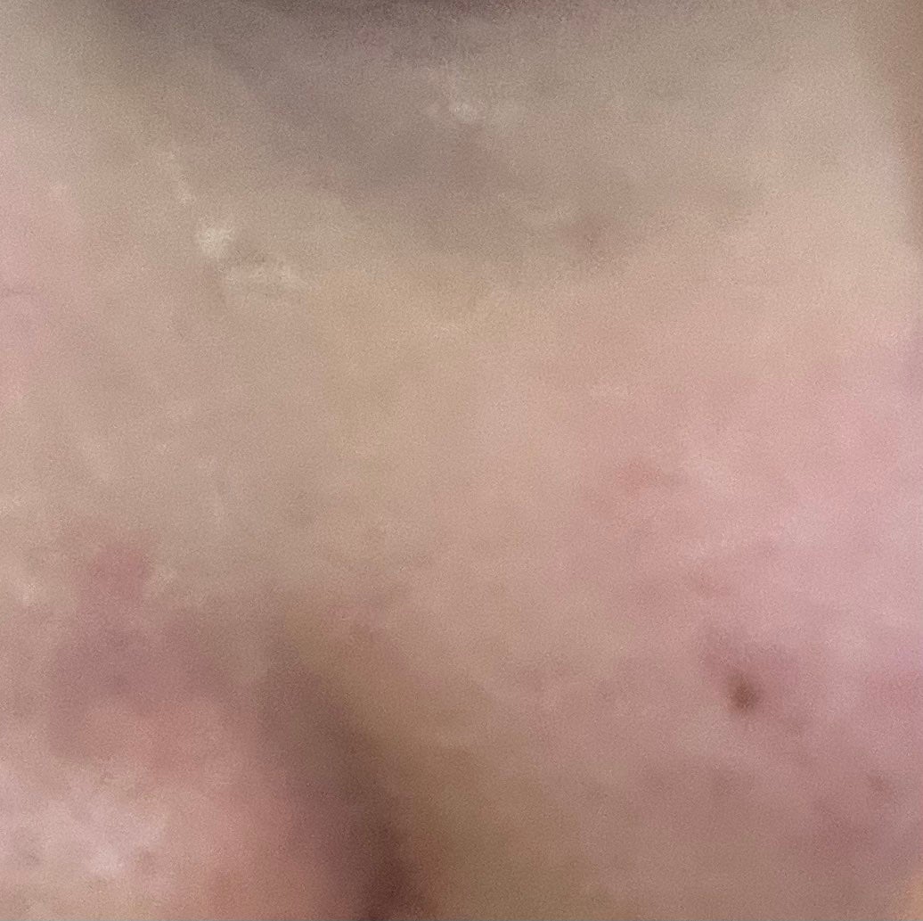 カラーミキシングコンシーラー/キャンメイク/パレットコンシーラーを使ったクチコミ(1枚目)