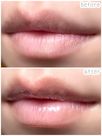 エッセンス リッププランパー/Visée/リッププランパーを使ったクチコミ(3枚目)