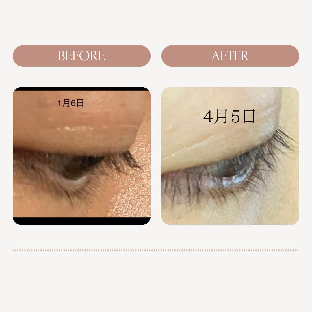 ラッシュアディクト アイラッシュコンディショニングセラム/soaddicted/まつげ美容液を使ったクチコミ（3枚目）