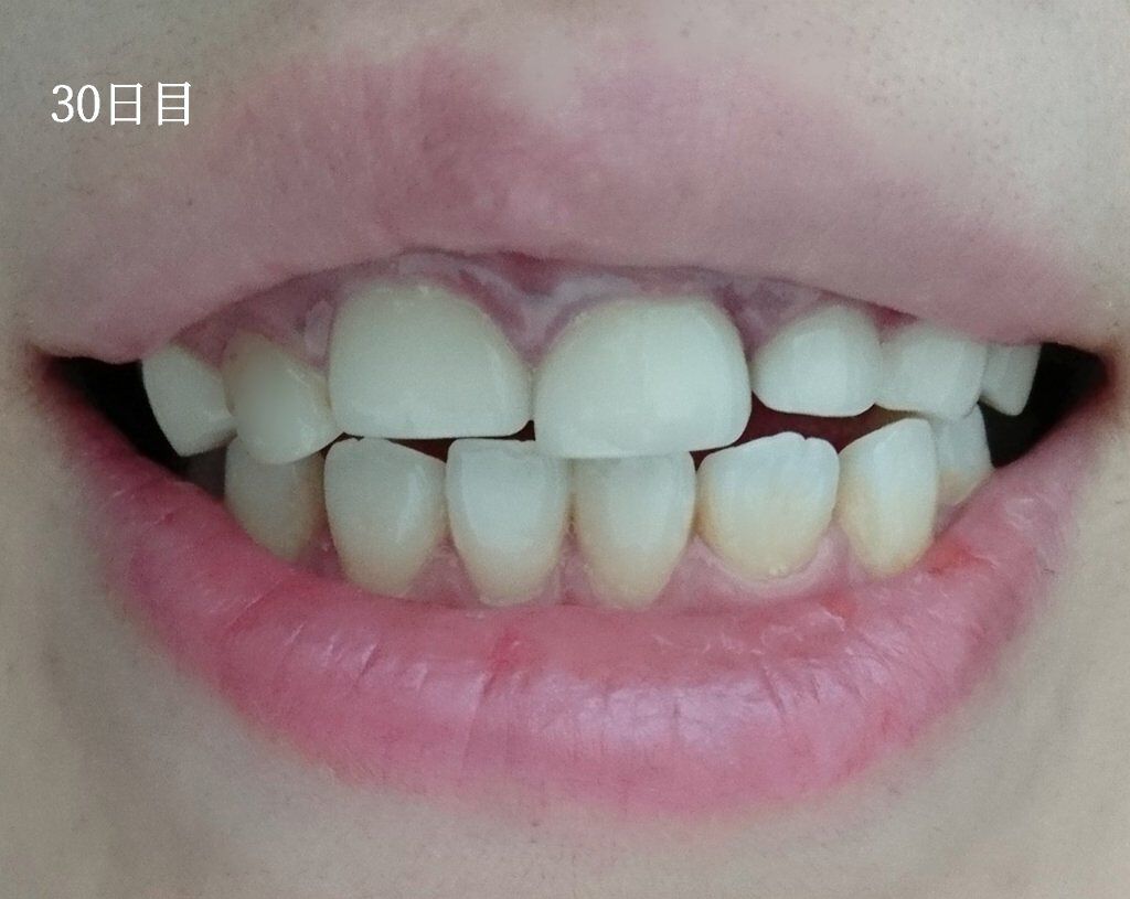 ðð®ðððð¢â¡ on LIPS ãããã«ã¡ã¯ïŒä»¥åã¹ãã·ã£ã«ãªã»ãããé ããŸããŠCOCOWHIT..ãïŒ4æç®ïŒ