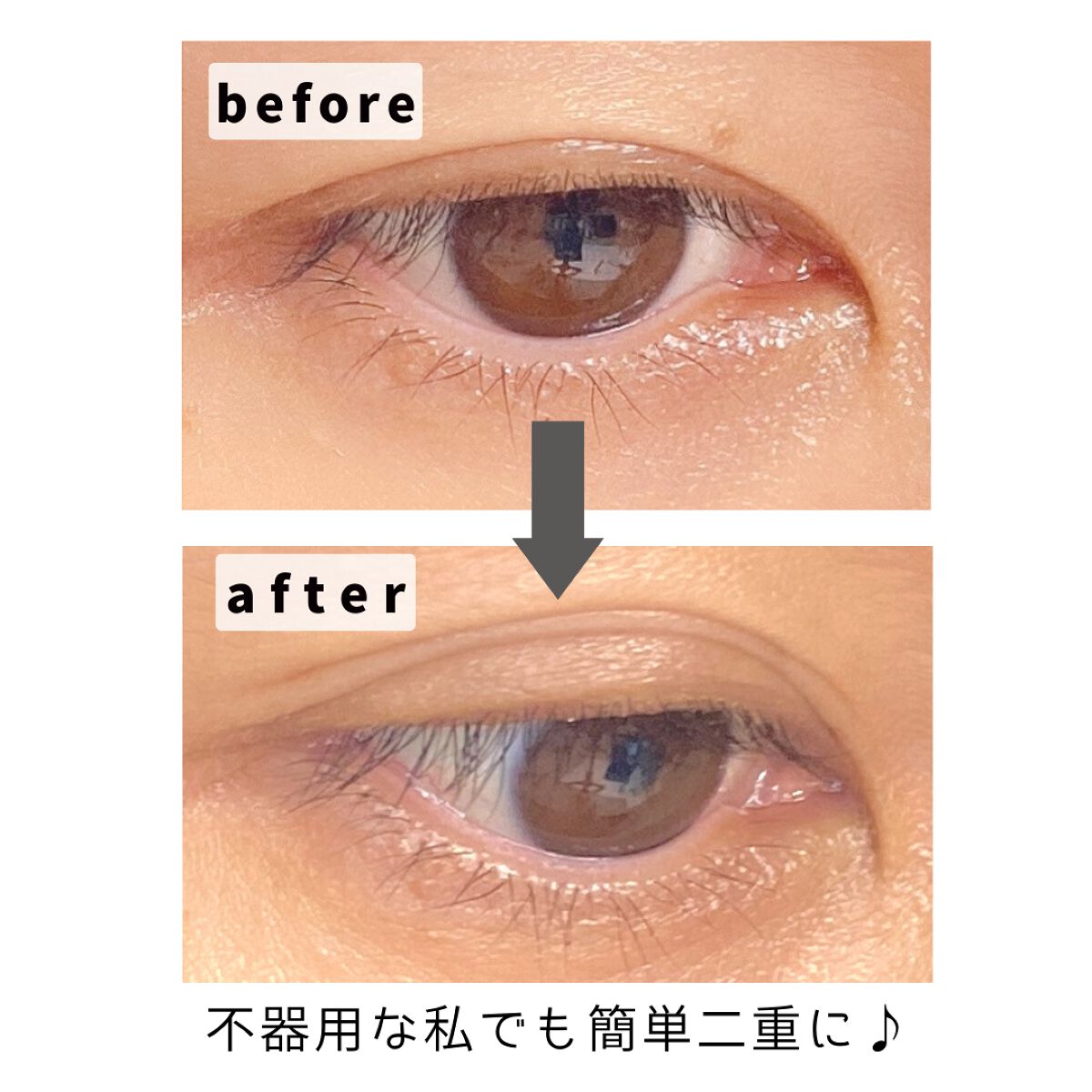 湘南美容アイリッドグルー/湘南美容/二重まぶた用アイテムを使ったクチコミ(3枚目)