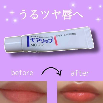 モアリップ N (医薬品)/資生堂薬品/その他を使ったクチコミ(1枚目)