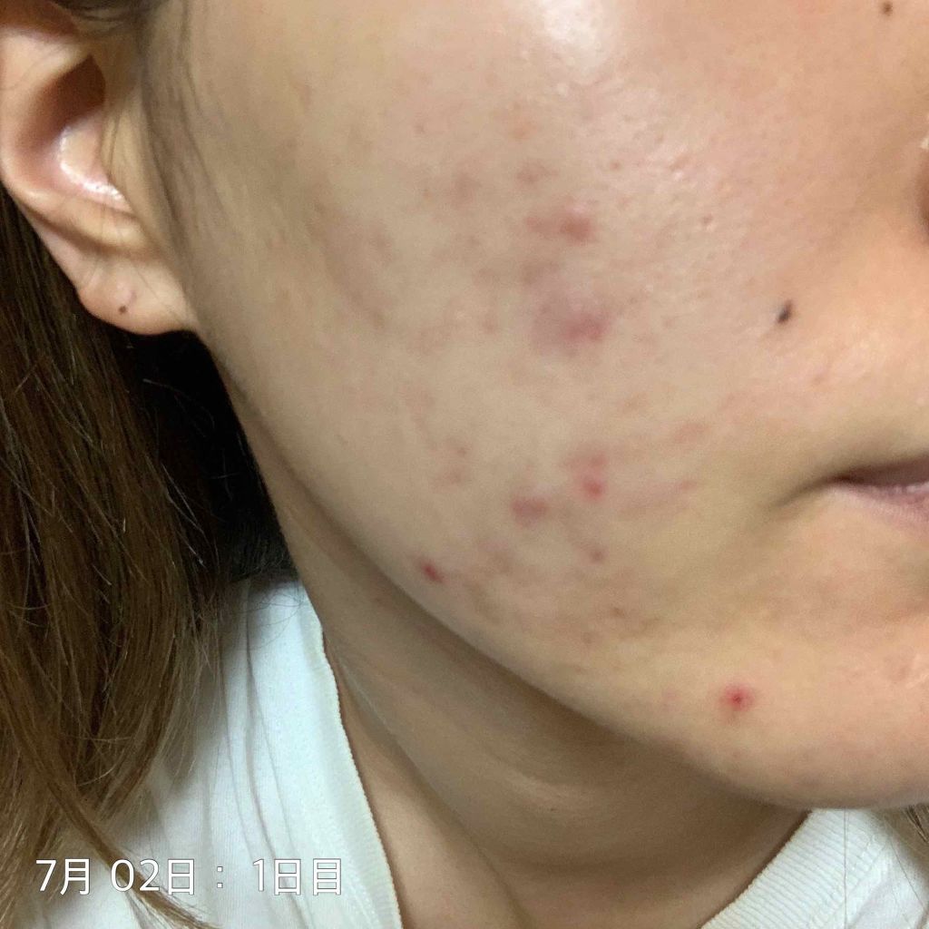 ハトムギ保湿ジェル(ナチュリエ スキンコンディショニングジェル)/ナチュリエ/美容液を使ったクチコミ（3枚目）