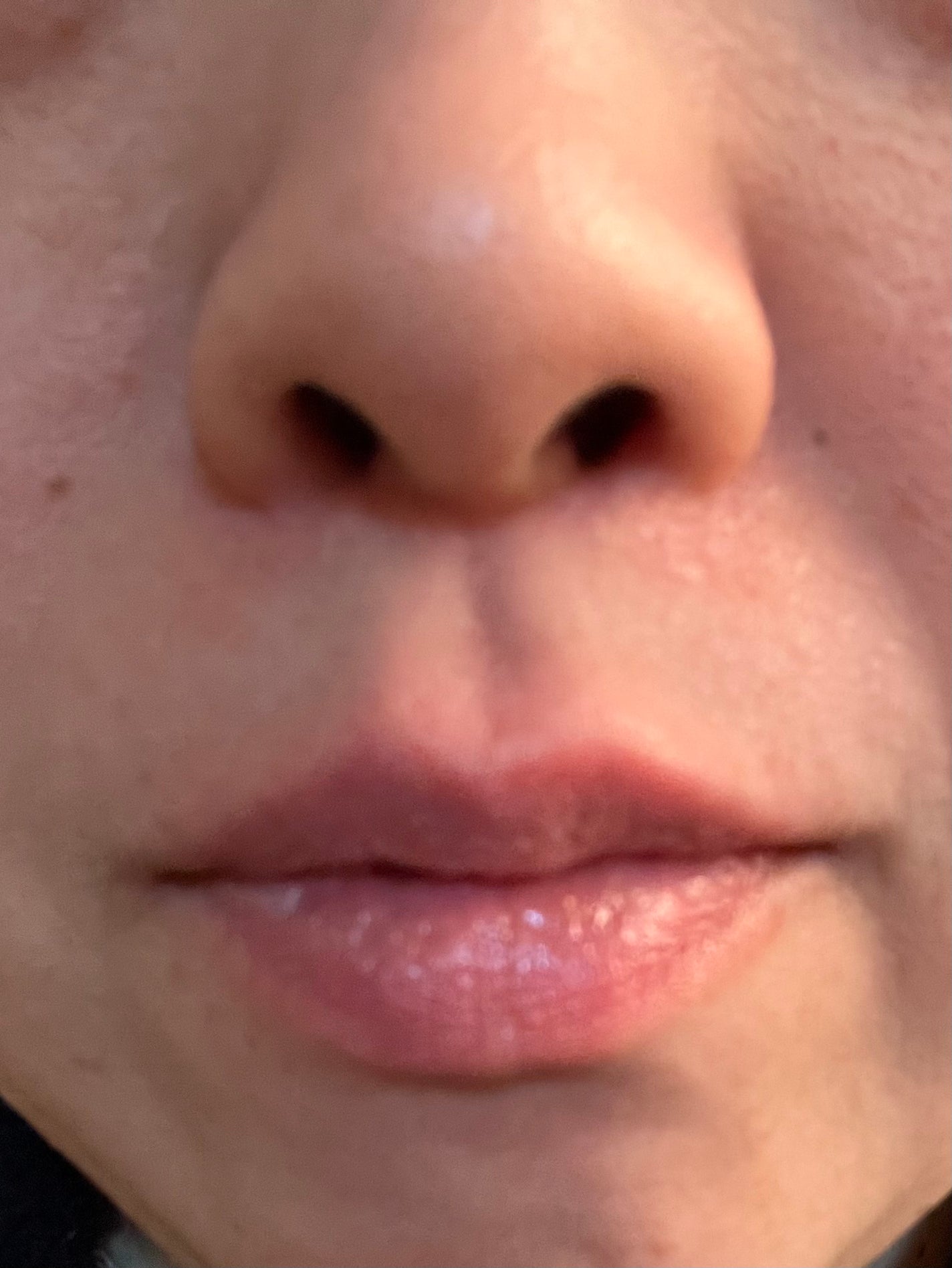 イリュン コラーゲンモイスチャーリップマスク/illuN/リップマスクを使ったクチコミ(7枚目)