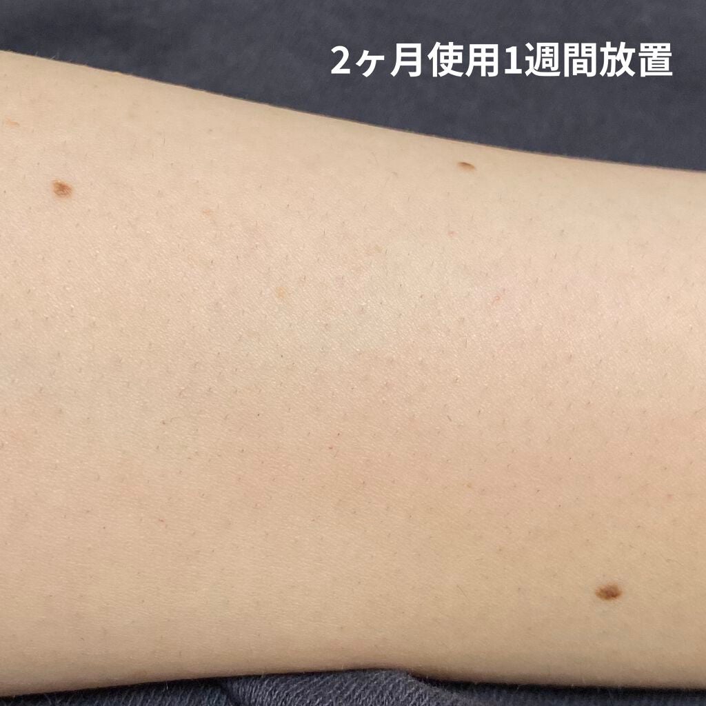 試してみた】FASIZ HAIR REMOVAL 家庭用脱毛器/FASIZ | LIPS