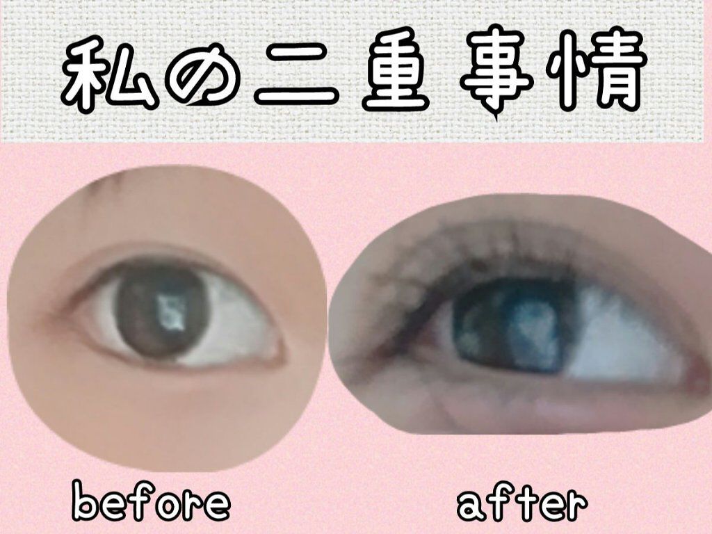 両面二重テープ/DAISO/二重まぶた用アイテムを使ったクチコミ（1枚目）