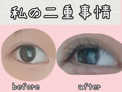 ワンダーアイリッドテープ Extra/D-UP/二重まぶた用アイテムを使ったクチコミ(1枚目)