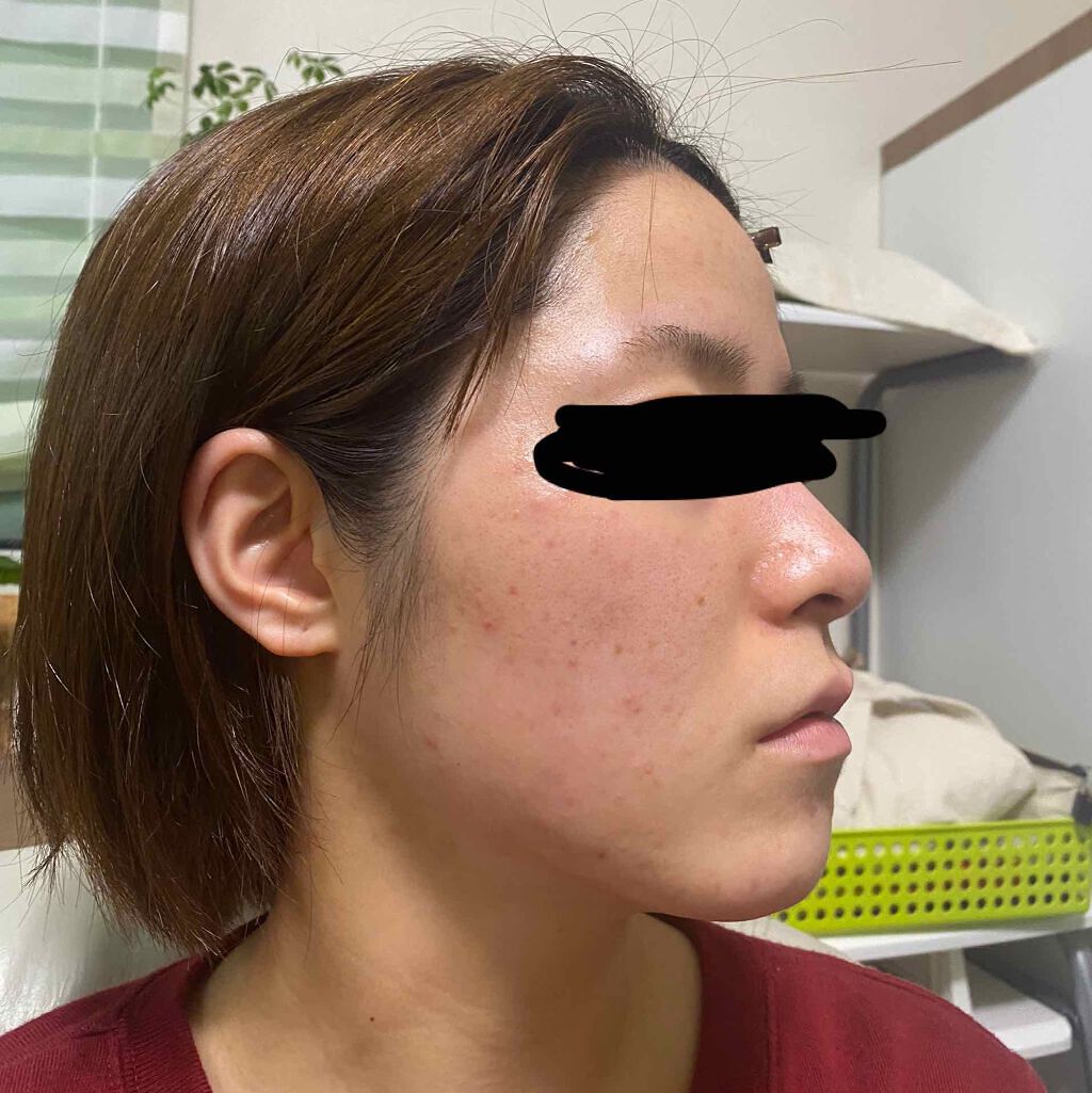 ルルルンプレシャス RED(モイスト)【旧】/ルルルン/シートマスク・パックを使ったクチコミ（1枚目）