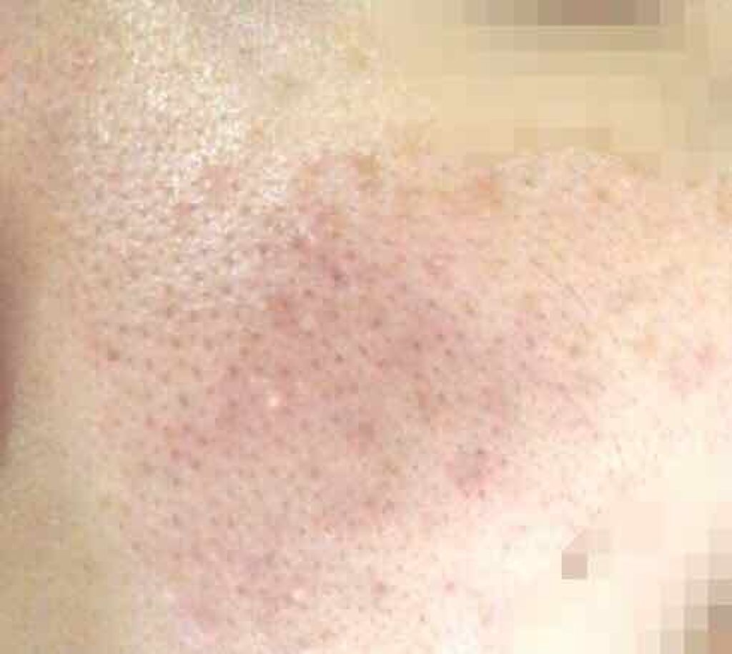 ハトムギ化粧水(ナチュリエ スキンコンディショナー R )/ナチュリエ/化粧水を使ったクチコミ（3枚目）