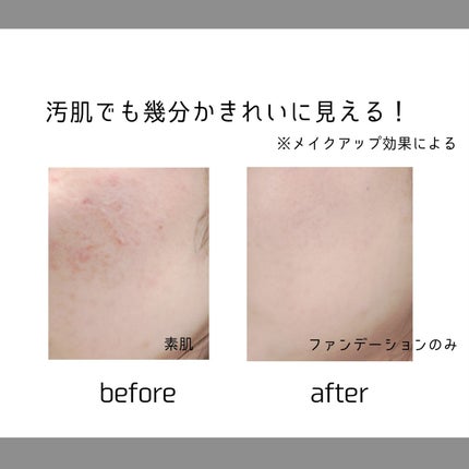 キル カバー ファンウェア クッション ザ オリジナル/CLIO/クッションファンデーションを使ったクチコミ(4枚目)