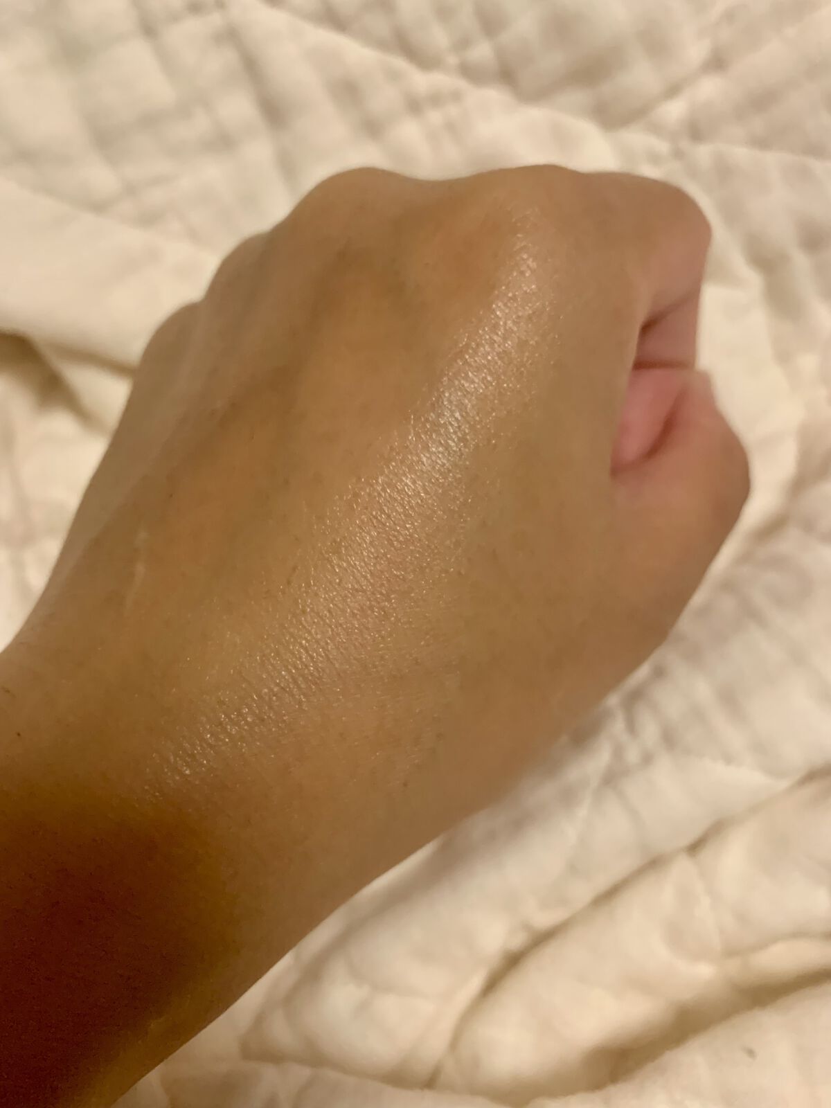 ミュゼコスメ アクネケアミストのクチコミ「出産してからというもの
自分の体のケアは正直適当になってて

他の部位は乾燥するしボディークリ.....」（3枚目）