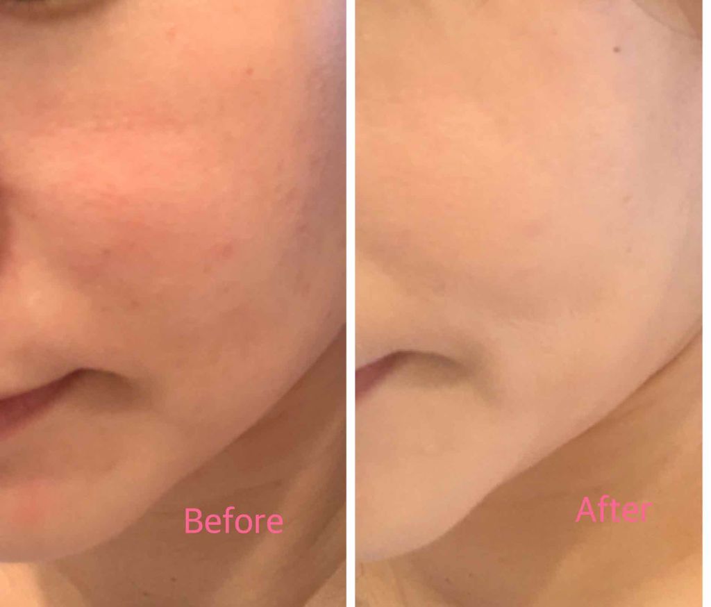 M クッション ファンデーション(プロカバー)/MISSHA/クッションファンデーションを使ったクチコミ(2枚目)