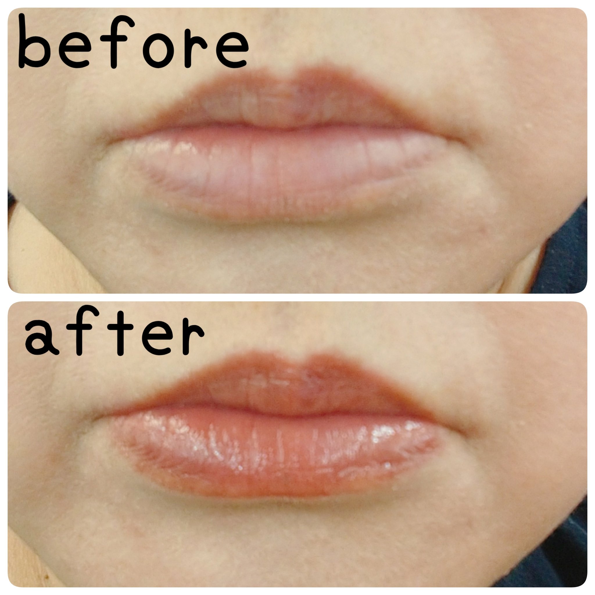 アンドバイロムアンド　グラッシーボムティント/&nd by rom&nd/リップティントを使ったクチコミ（2枚目）