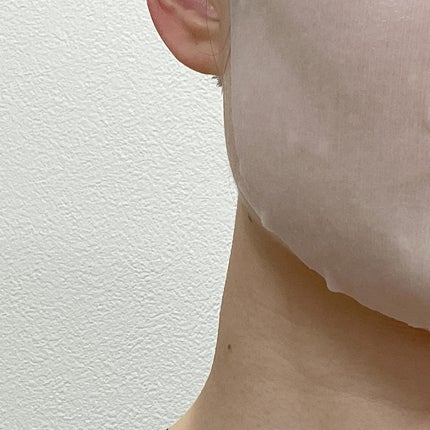 ダーマレーザースペクター VCMAX マスク/クオリティファースト/シートマスク・パックを使ったクチコミ(4枚目)