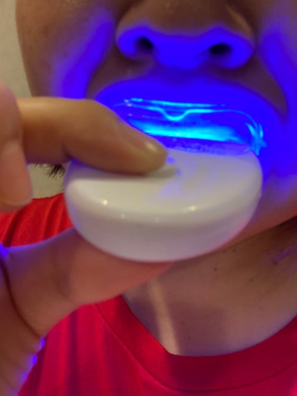 ルルホワイト/ルルシア/その他オーラルケアを使ったクチコミ(4枚目)