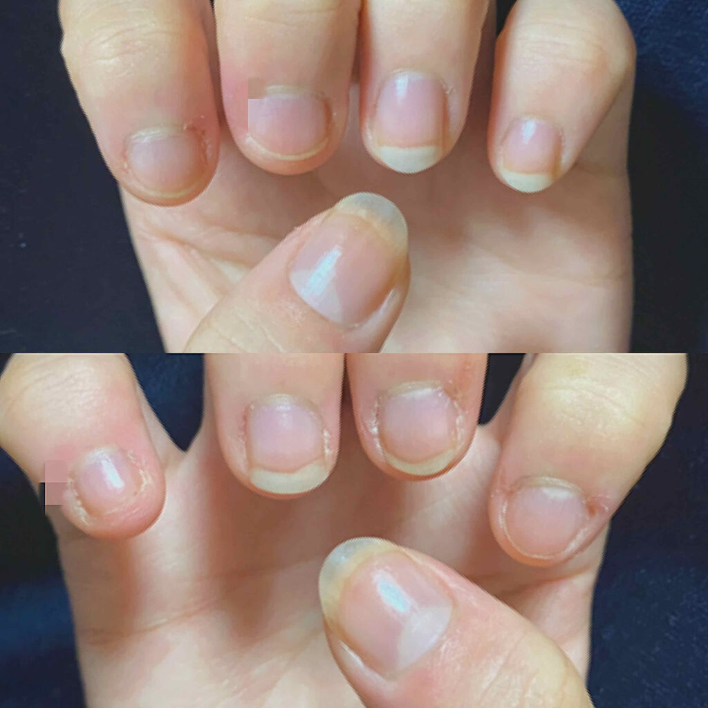 キューティクルトリートメントオイル ブルームーンライト/DHC/ネイルオイル・トリートメントを使ったクチコミ（2枚目）