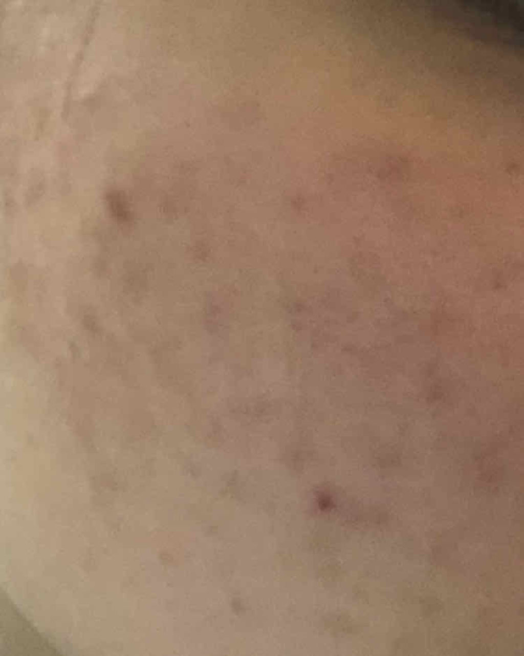 明色美顔水 薬用化粧水/美顔/化粧水を使ったクチコミ（3枚目）