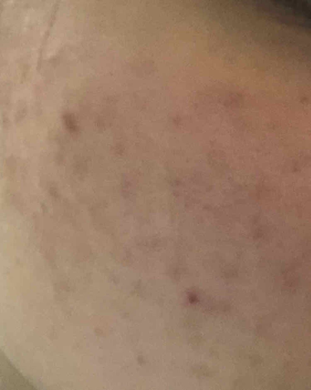 明色美顔水 薬用化粧水/美顔/化粧水を使ったクチコミ(3枚目)