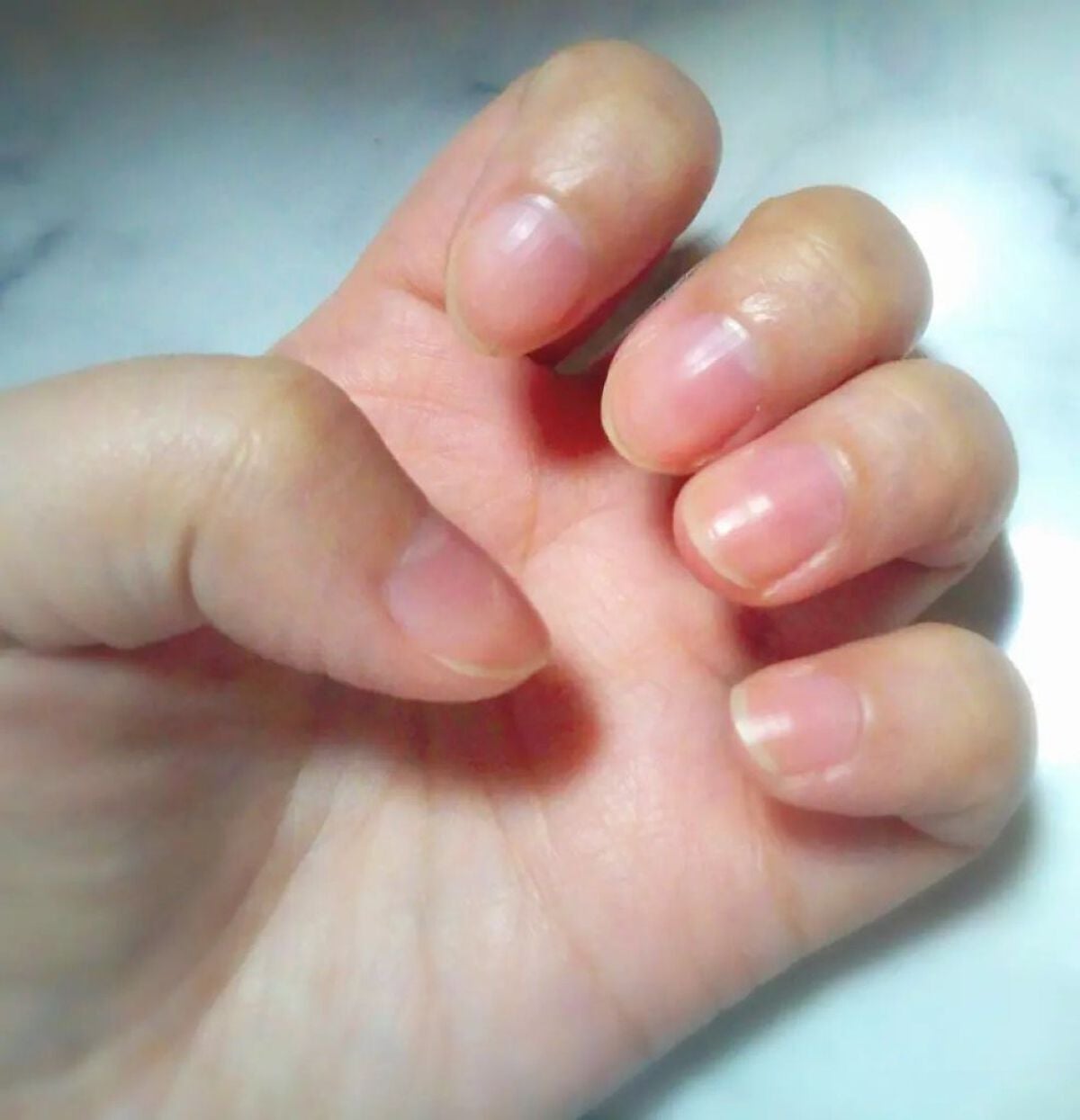 1Day密封ネイルケアパック/DAILY NAILLY/ネイルオイル・トリートメントを使ったクチコミ(4枚目)