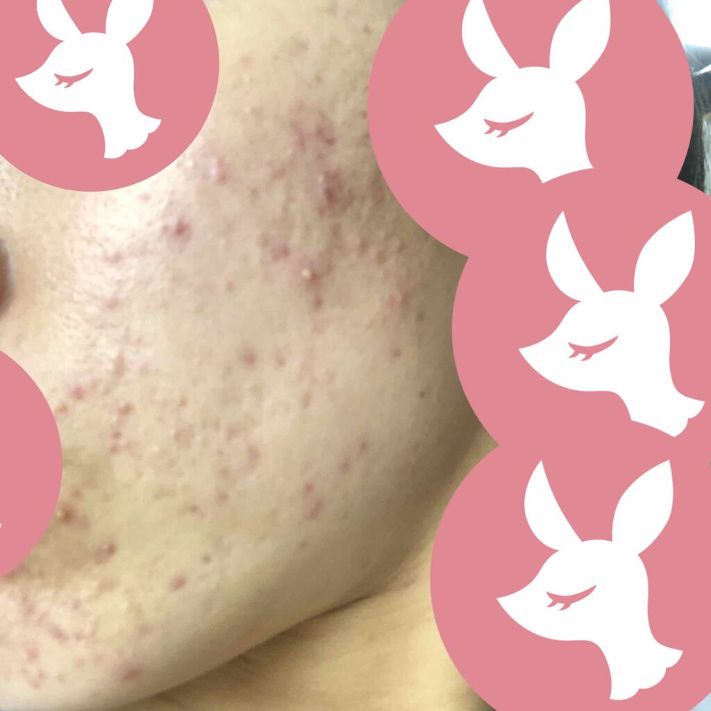 薬用エマルジョン/IHADA/乳液を使ったクチコミ（2枚目）