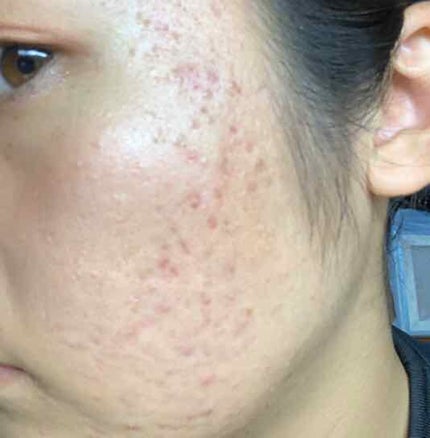 EclatCharme(エクラシャルム)/FABIUS/オールインワン化粧品を使ったクチコミ(2枚目)