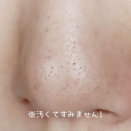 ソフティモ 薬用ホワイト クレンジングウォッシュ/ソフティモ/洗顔フォームを使ったクチコミ(7枚目)