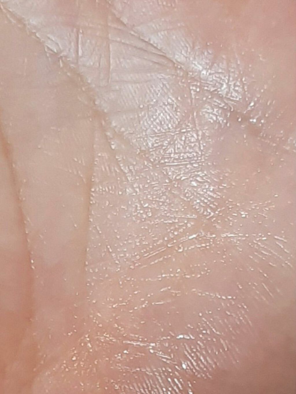 ハイドロキノン2.5%配合ランテルノホワイトHQクリーム/LANTELNO/フェイスクリームを使ったクチコミ(5枚目)