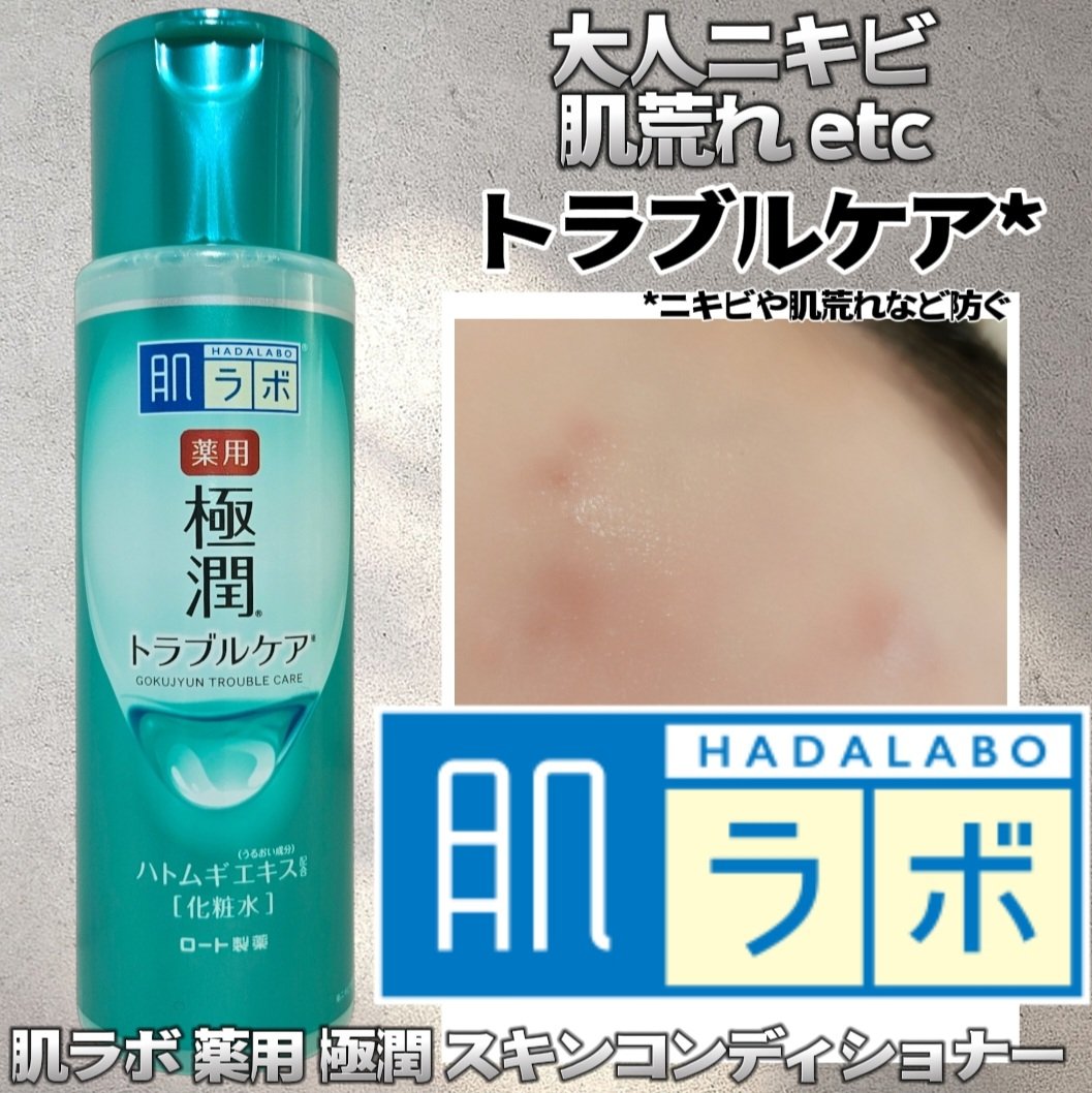 薬用 極潤 スキンコンディショナー 170ml（ボトル）/肌ラボ/化粧水を使ったクチコミ（1枚目）