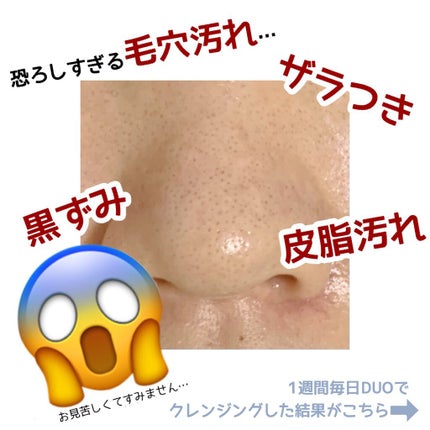 デュオ ザ クレンジングバーム ブラック/DUO/クレンジングバームを使ったクチコミ(4枚目)