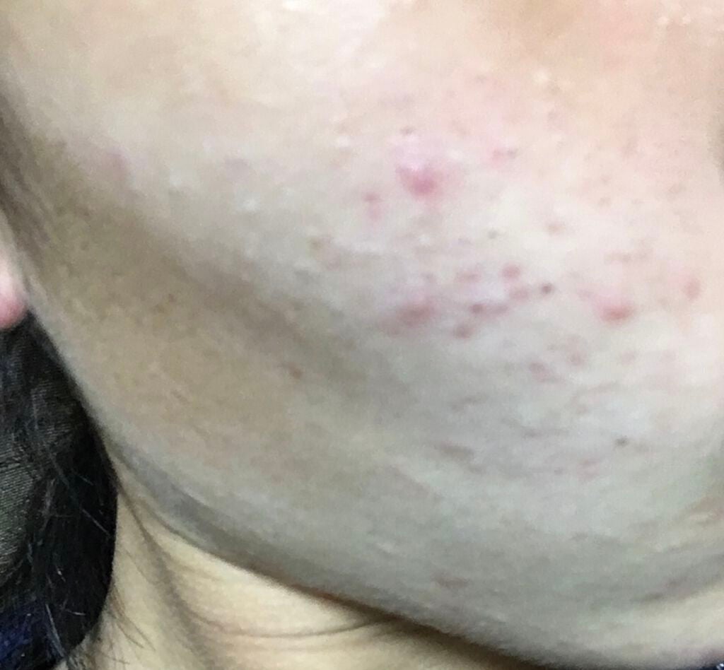 ウオーター/アベンヌ/ミスト状化粧水を使ったクチコミ(3枚目)