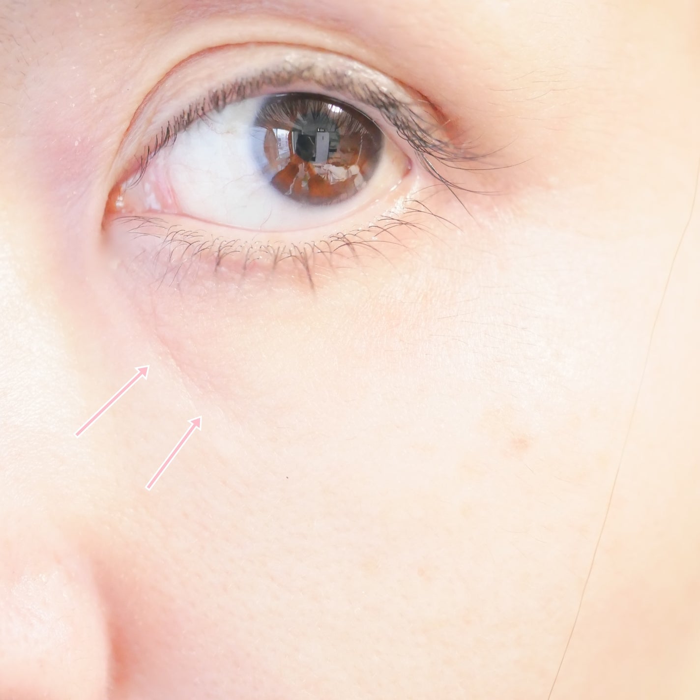 プロバイオシカ インテンシブ アンプル/SKIN1004/美容液を使ったクチコミ(9枚目)