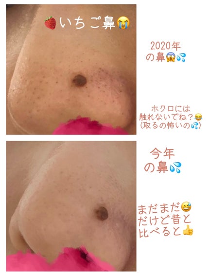 エマルジョンリムーバー 300ml/200ml/水橋保寿堂製薬/その他洗顔料を使ったクチコミ(2枚目)