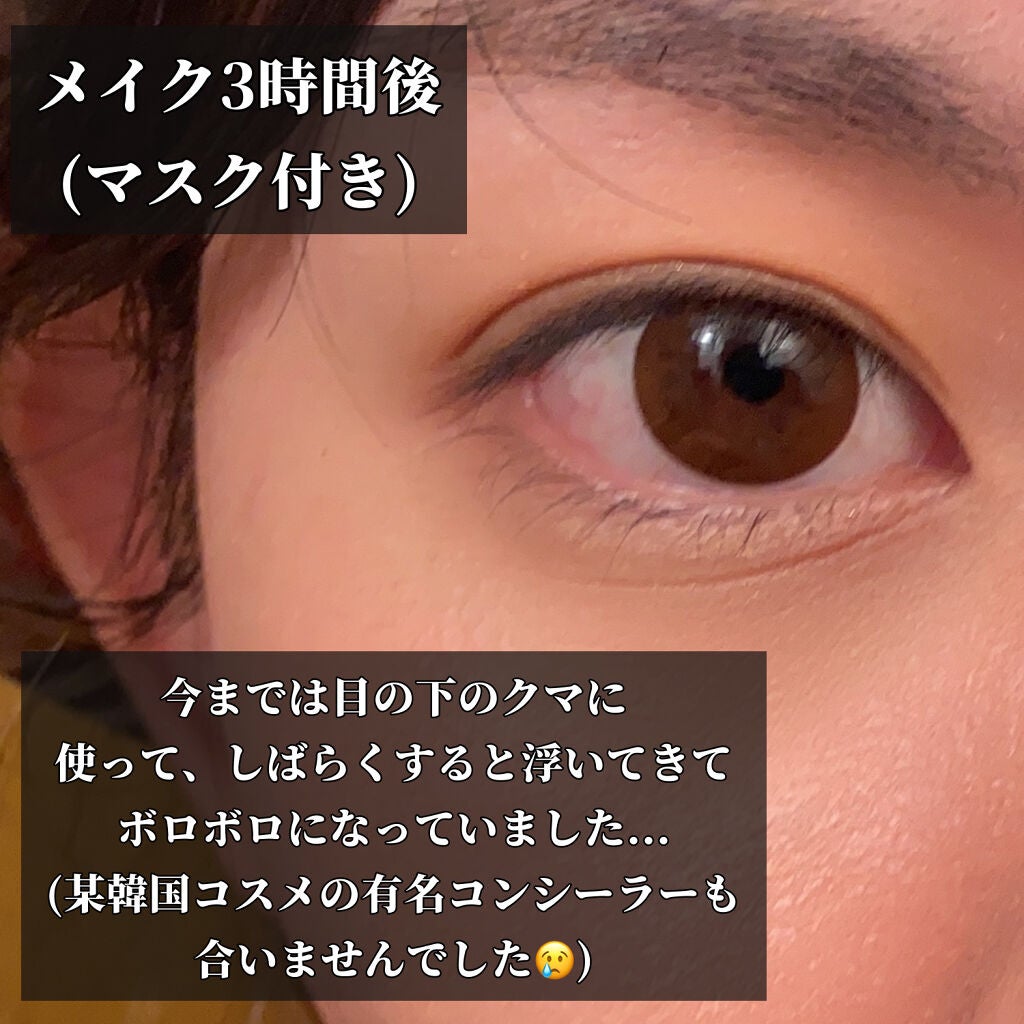 【旧】ディオールスキン フォーエヴァー スキン コレクト コンシーラー/Dior/リキッドコンシーラーを使ったクチコミ(6枚目)