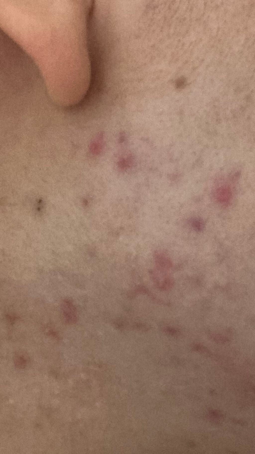 清潔感Quest on LIPS 「スキンケア商品探してる😭マスクで当たるところの肌荒れが特にやば..」(1枚目)