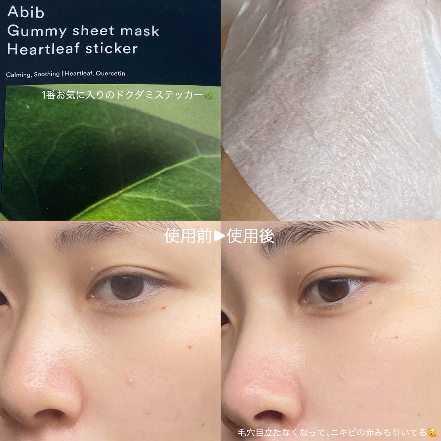 ガムシートマスク アクアステッカー/Abib /シートマスク・パックを使ったクチコミ(3枚目)