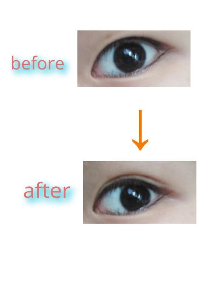 オリシキ アイリッドスキンフィルム /D-UP/二重まぶた用アイテムを使ったクチコミ(6枚目)