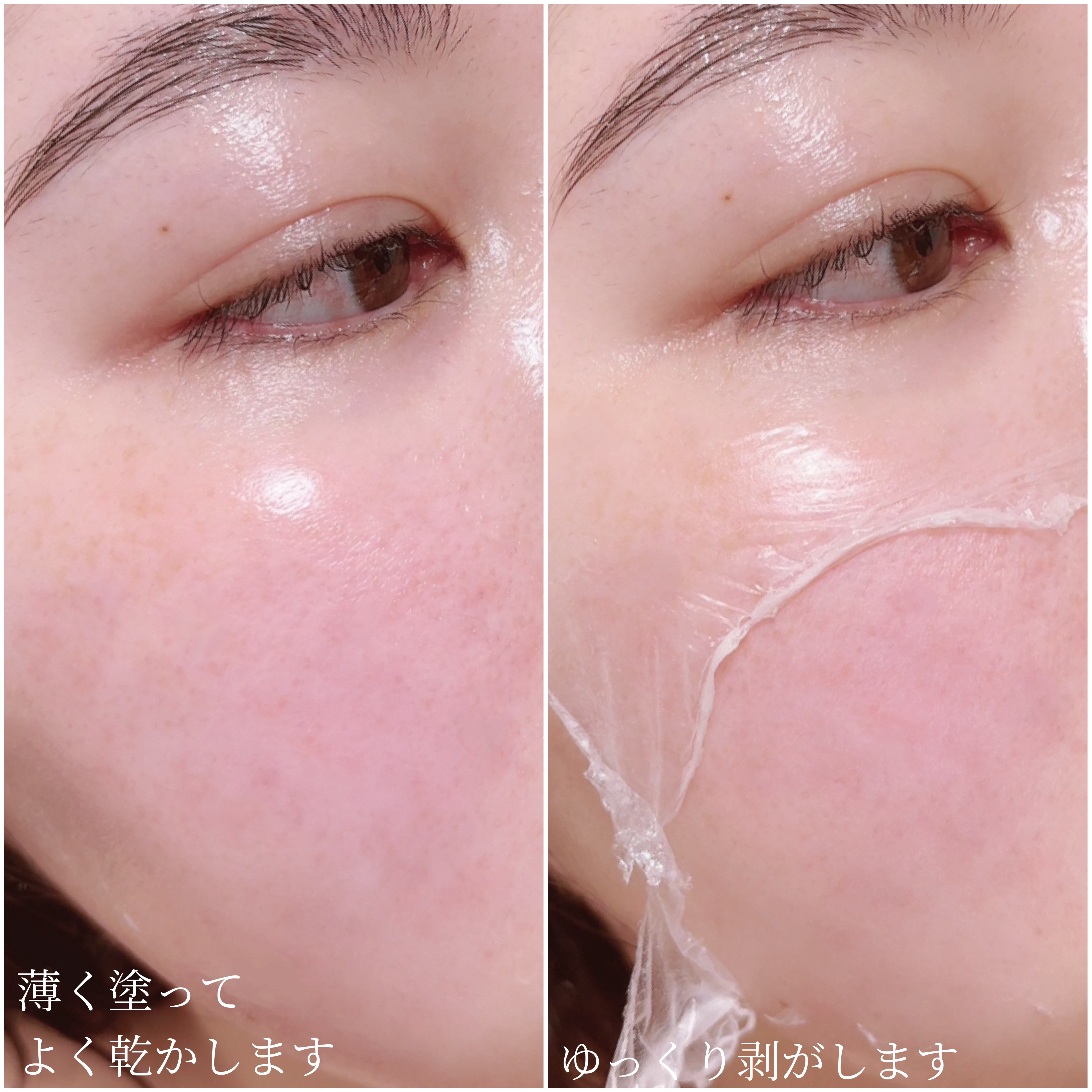 レッドラクトコラーゲンクリーム/MEDIPEEL/フェイスクリームを使ったクチコミ（3枚目）