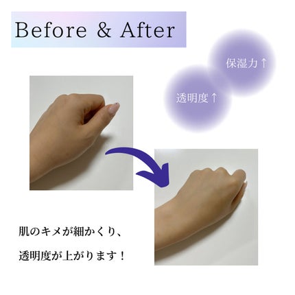 バイオ コンディショニング エッセンス/IOPE/ブースター・導入液を使ったクチコミ(3枚目)