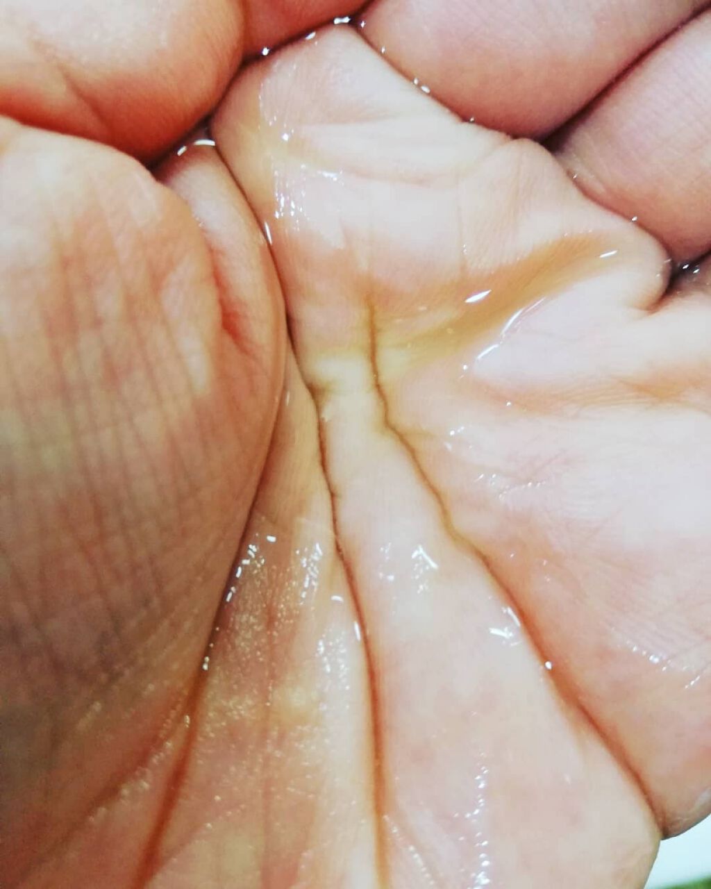 ヘッドスパセブン トリートメント/ヘッドスパセブン/頭皮トリートメントを使ったクチコミ（3枚目）